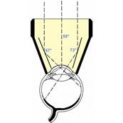Ocular - 3 Miroirs Diagnostic et Laser – 18 mm